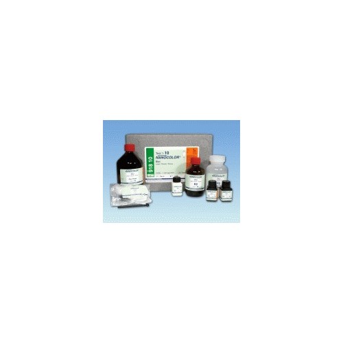 Piombo senza tetraclorometano (0,005 - 1,00 mg/l)